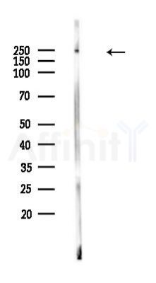 CAD Antibody - Western blot analysis of lysates from EC304 cells, using CAD Antibody at 1/1000 dilution.