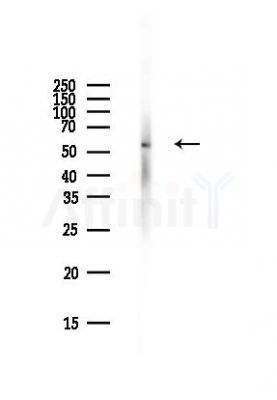 CDC25C Antibody - Western blot analysis of lysates from Rat liver, using CDC25C Antibody at 1/1000 dilution.