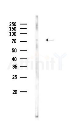 SYK Antibody - Western blot analysis of lysates from PC12 cells, using SYK Antibody at 1/1000 dilution.