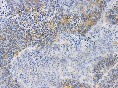 SYK Antibody - AF4732 at 1/100 staining human normal lung tissue by IHC-P.