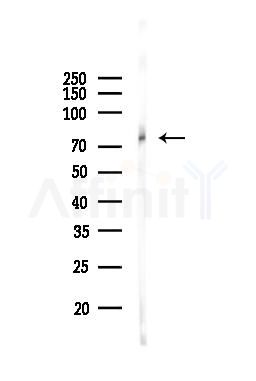 NUMB Antibody - Western blot analysis of lysates from A549 cells, using NUMB Antibody at 1/1000 dilution.