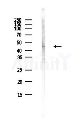 CDK9 Antibody - Western blot analysis of lysates from MCF7 cells(heat-shock,45min treatment), using CDK9 Antibody at 1/1000 dilution.