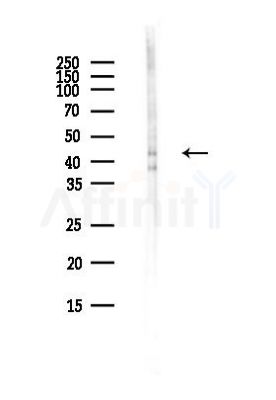 CDK9 Antibody - Western blot analysis of lysates from COLO205 cells(heat-shock,45min treatment), using CDK9 Antibody at 1/1000 dilution.