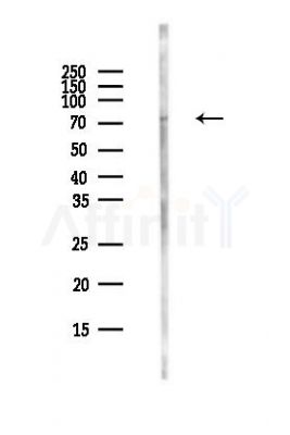IRAK1 Antibody - Western blot analysis of lysates from MCF7 cells(heat-shock,45min treatment), using IRAK1 Antibody at 1/1000 dilution.
