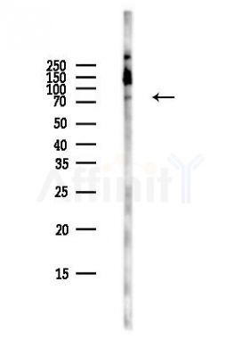 IRAK1 Antibody - Western blot analysis of lysates from Rat liver, using IRAK1 Antibody at 1/1000 dilution.