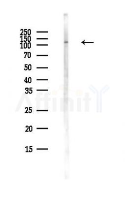 Eg5 Antibody - Western blot analysis of lysates from MCF7 cells(heat-shock,45min treatment), using Eg5 Antibody at 1/1000 dilution.