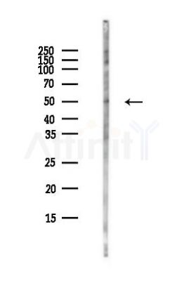 FOXL2 Antibody - Western blot analysis of lysates from COLO205 cells(heat-shock,45min treatment), using FOXL2 Antibody at 1/1000 dilution.