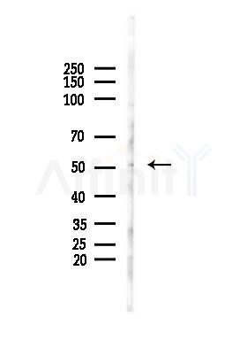 PTEN Antibody - Western blot analysis of lysates from PC12 cells, using PTEN Antibody at 1/1000 dilution.
