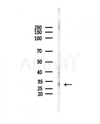 PP2A-alpha Antibody - Western blot analysis of lysates from PC12 cells, using PP2A-alpha Antibody at 1/1000 dilution.
