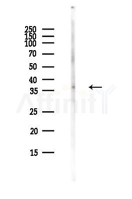 MCL1 Antibody - Western blot analysis of lysates from COLO205 cells(heat-shock,45min treatment), using MCL1 Antibody at 1/1000 dilution.