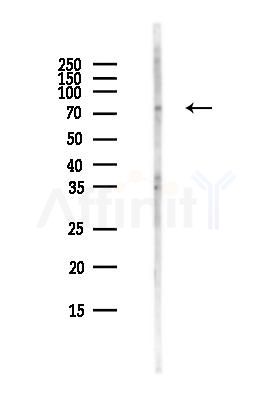 SLP76 Antibody - Western blot analysis of lysates from COLO205 cells(heat-shock,45min treatment), using SLP76 Antibody at 1/1000 dilution.