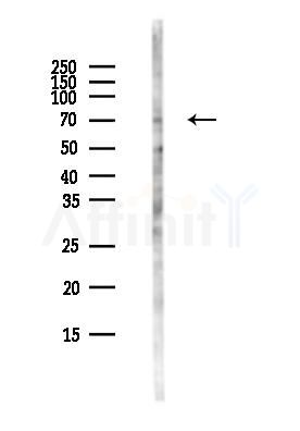 SLP76 Antibody - Western blot analysis of lysates from COLO205 cells(heat-shock,45min treatment), using SLP76 Antibody at 1/1000 dilution.