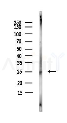 MOB1A Antibody - Western blot analysis of lysates from HepG2 cells(starvation,24h treatment), using MOB1A Antibody at 1/1000 dilution.