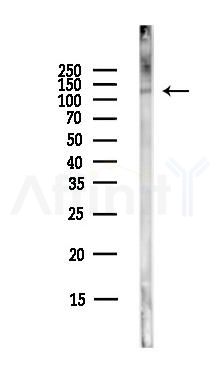CARD11 Antibody - Western blot analysis of lysates from HepG2 cells(LPS,4h treatment), using CARD11 Antibody at 1/1000 dilution.