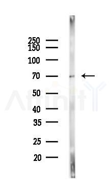 PINK1 Antibody - Western blot analysis of lysates from Mouse lung, using PINK1 Antibody at 1/1000 dilution.