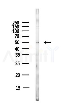 PINK1 Antibody - Western blot analysis of lysates from HepG2 cells(LPS,4h treatment), using PINK1 Antibody at 1/1000 dilution.
