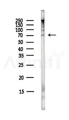 RanBP3 Antibody - Western blot analysis of lysates from HepG2 cells(LPS,4h treatment), using RanBP3 Antibody at 1/1000 dilution.