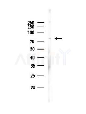 RAD18 Antibody - Western blot analysis of lysates from A549 cells, using RAD18 Antibody at 1/1000 dilution.