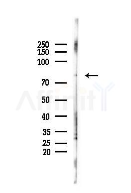 RAD18 Antibody - Western blot analysis of lysates from PC12 cells, using RAD18 Antibody at 1/1000 dilution.