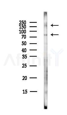 ALK Antibody - Western blot analysis of lysates from HepG2 cells(LPS,4h treatment), using ALK Antibody at 1/1000 dilution.