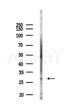 DAPP1/BAM32 Antibody - Western blot analysis of lysates from Rat lung, using DAPP1/BAM32 Antibody at 1/1000 dilution.