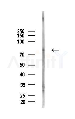 SYK Antibody - Western blot analysis of lysates from Mouse testis, using SYK Antibody at 1/1000 dilution.