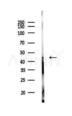 GSK3 beta Antibody - Western blot analysis of lysates from Rat lung, using GSK3 beta Antibody at 1/1000 dilution.
