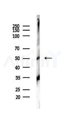 Cytokeratin 13 Antibody - Western blot analysis of lysates from PC12 cells(LPS,4h treatment), using Cytokeratin 13 Antibody at 1/1000 dilution.