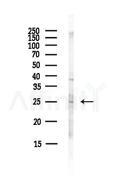 CD63 Antibody - Western blot analysis of lysates from HepG2 cells(LPS,4h treatment), using CD63 Antibody at 1/1000 dilution.