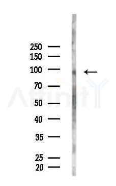 CD133 Antibody - Western blot analysis of lysates from PC12 cells(LPS,4h treatment), using CD133 Antibody at 1/1000 dilution.