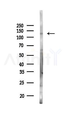 Vinculin Antibody - Western blot analysis of lysates from Mouse lung, using Vinculin Antibody at 1/1000 dilution.