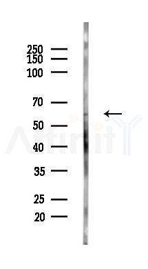 Angiopoietin 2 Antibody - Western blot analysis of lysates from PC12 cells(LPS,4h treatment), using Angiopoietin 2 Antibody at 1/1000 dilution.