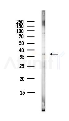 E2F5 Antibody - Western blot analysis of lysates from HepG2 cells(LPS,4h treatment), using E2F5 Antibody at 1/1000 dilution.