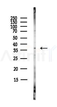 E2F5 Antibody - Western blot analysis of lysates from HepG2 cells(starvation,24h treatment), using E2F5 Antibody at 1/1000 dilution.
