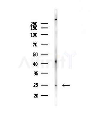 SOD2/MnSOD Antibody - Western blot analysis of lysates from Rat brain, using SOD2/MnSOD Antibody at 1/1000 dilution.