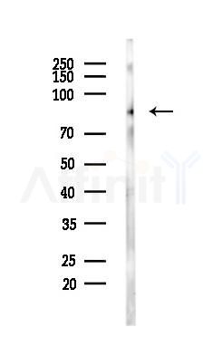 EZH2 Antibody - Western blot analysis of lysates from MDA-MB-231 cells(heat-shock,45min treatment), using EZH2 Antibody at 1/1000 dilution.