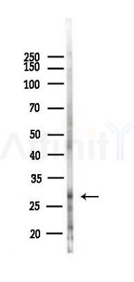 AQP5 Antibody - Western blot analysis of lysates from Hela cells(heat-shock,45min treatment), using AQP5 Antibody at 1/1000 dilution.