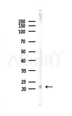 EPO Antibody - Western blot analysis of lysates from Mouse liver, using EPO Antibody at 1/1000 dilution.