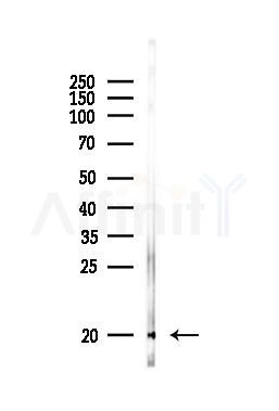 SOD1 Antibody - Western blot analysis of lysates from PC12 cells, using SOD1 Antibody at 1/1000 dilution.