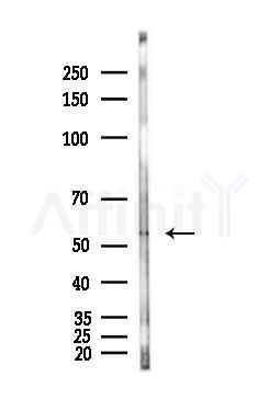 Cytochrome P450 17A1 Antibody - Western blot analysis of lysates from Hela cells(heat-shock,45min treatment), using Cytochrome P450 17A1 Antibody at 1/1000 dilution.