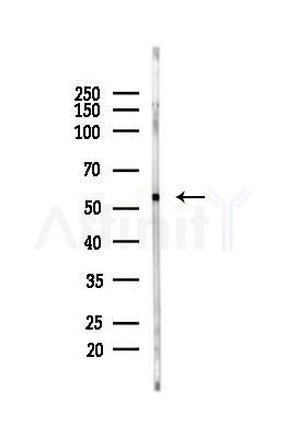 Cytochrome P450 17A1 Antibody - Western blot analysis of lysates from Mouse liver, using Cytochrome P450 17A1 Antibody at 1/1000 dilution.