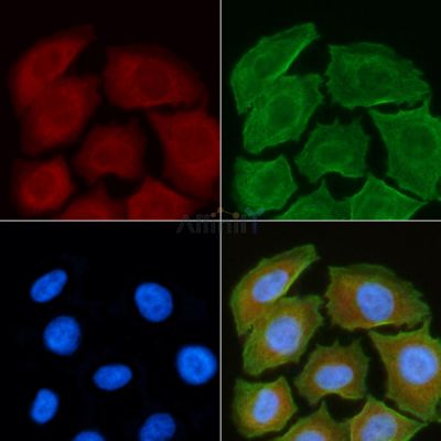 PRLHR Antibody - AF5212 staining Hela cells(30min of UV treatment) by IF/ICC.