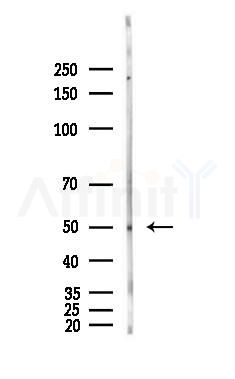 Cytokeratin 14 Antibody - Western blot analysis of lysates from Hela cells(heat-shock,45min treatment), using Cytokeratin 14 Antibody at 1/1000 dilution.
