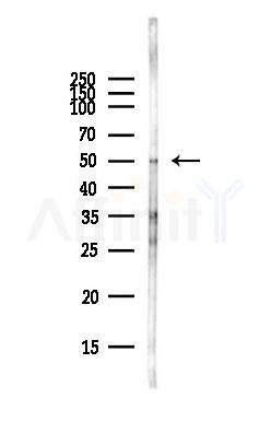Cytochrome P450 19A1 Antibody - Western blot analysis of lysates from COLO205 cells(heat-shock,45min treatment), using Cytochrome P450 19A1 Antibody at 1/1000 dilution.