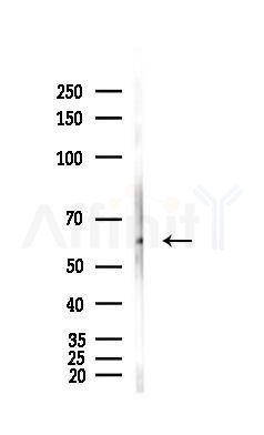 PKM2 Antibody - Western blot analysis of lysates from Hela cells(heat-shock,45min treatment), using PKM2 Antibody at 1/1000 dilution.