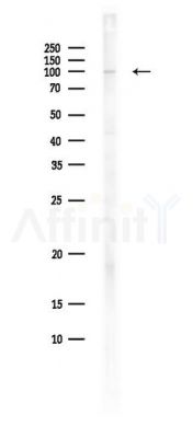 EPHB1 Antibody - Western blot analysis of lysates from Hela cells(starvation,24h treatment), using EPHB1 Antibody at 1/1000 dilution.