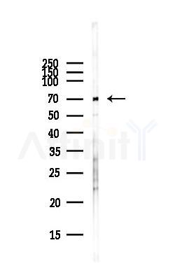 Smad4 Antibody - Western blot analysis of lysates from COLO205 cells(heat-shock,45min treatment), using Smad4 Antibody at 1/1000 dilution.