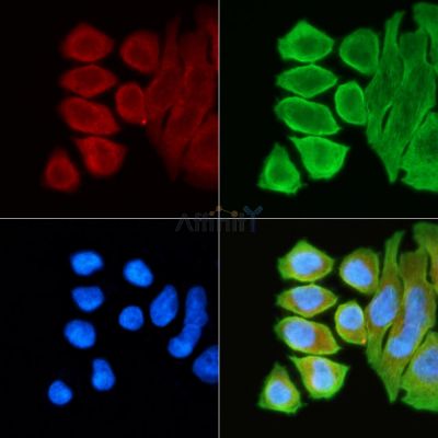 EPHA3 Antibody - AF5254 staining Hela cells(30min of UV treatment) by IF/ICC.