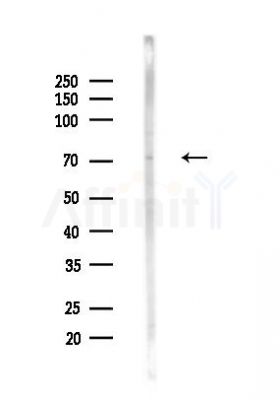 Cleaved-Notch2 (Ala1734) Antibody - Western blot analysis of lysates from LoVo cells(heat-shock,45min treatment), using Cleaved-Notch2 (Ala1734) Antibody at 1/1000 dilution.