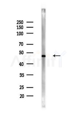 Cleaved-Caspase 8 (Asp384) Antibody - Western blot analysis of lysates from LoVo cells(heat-shock,45min treatment), using Cleaved-Caspase 8 (Asp384) Antibody at 1/1000 dilution.